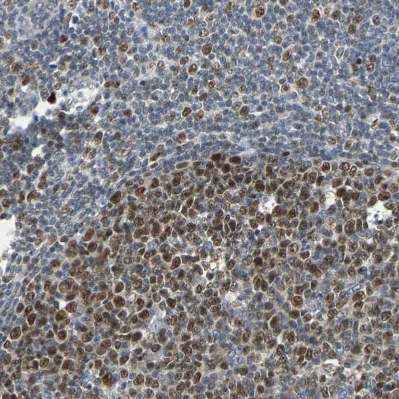 HLX1 Antibody - BSA Free Immunohistochemistry-Paraffin: HLX1 Antibody - BSA Free [NBP1-89719]