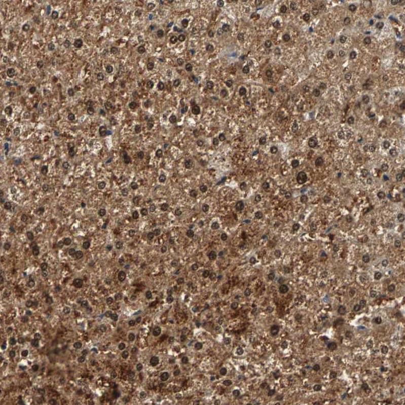 HLX1 Antibody - BSA Free Immunohistochemistry-Paraffin: HLX1 Antibody - BSA Free [NBP1-89719]