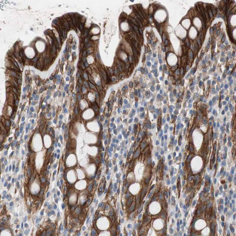 HAI-1/HGFA Inhibitor 1 Antibody - BSA Free Immunohistochemistry-Paraffin: HAI-1/HGFA Inhibitor 1 Antibody - BSA Free [NBP1-89720]