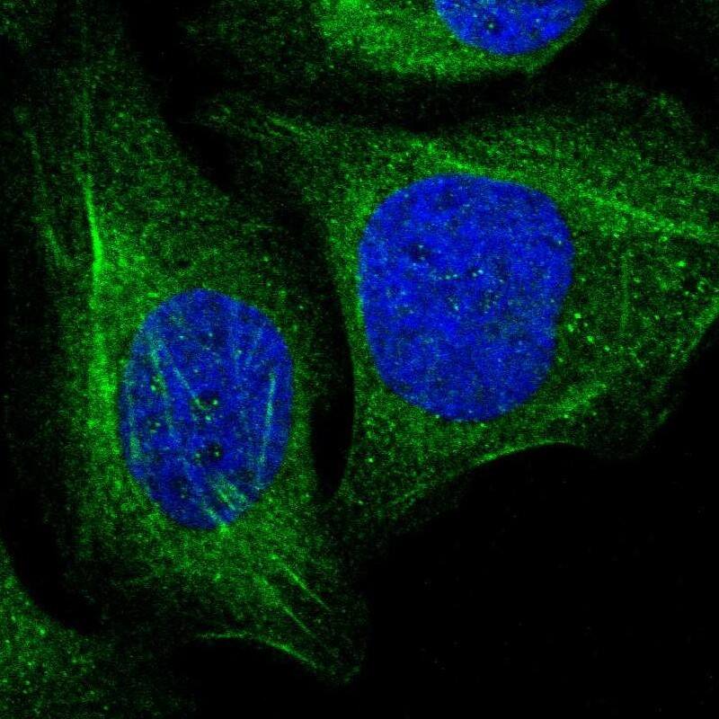 transgelin 2 Antibody - BSA Free Immunocytochemistry/ Immunofluorescence: transgelin 2 Antibody [NBP1-89722]