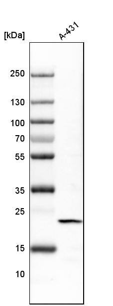 transgelin 2 Antibody - BSA Free Western Blot: transgelin 2 Antibody - BSA Free [NBP1-89722]