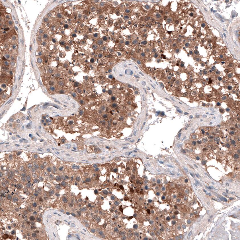 GTPBP9 Antibody - BSA Free Immunohistochemistry-Paraffin: GTPBP9 Antibody - BSA Free [NBP1-89725]