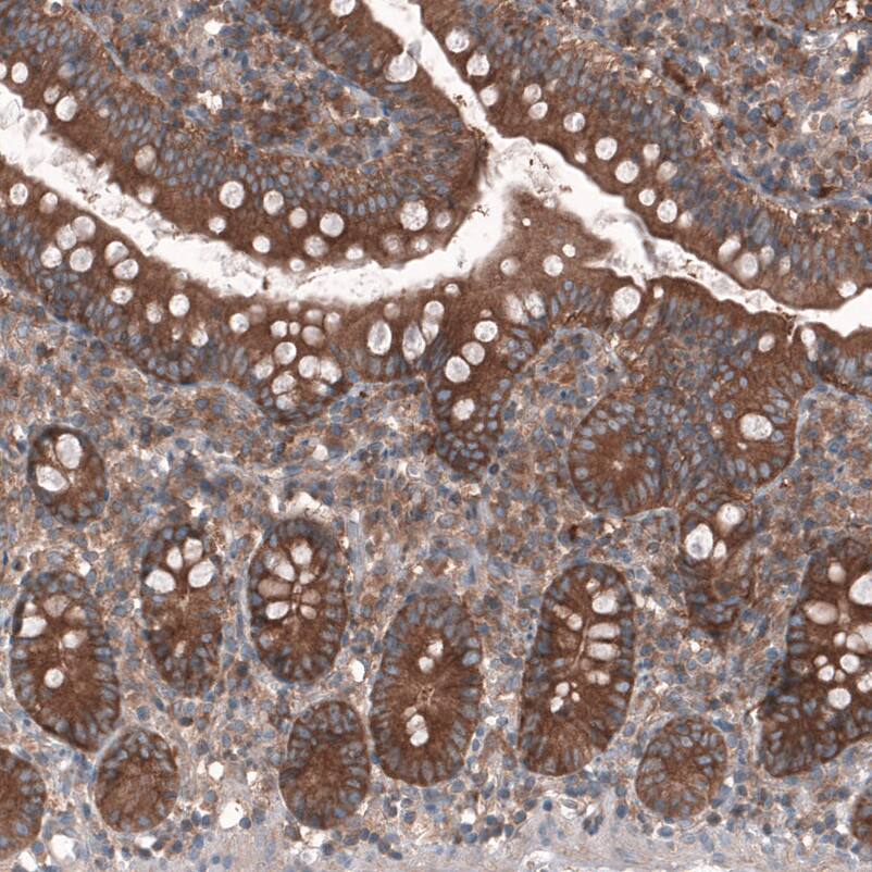 GTPBP9 Antibody - BSA Free Immunohistochemistry-Paraffin: GTPBP9 Antibody - BSA Free [NBP1-89725]