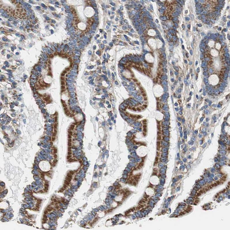 Glutathione S Transferase kappa 1 Antibody - BSA Free Immunohistochemistry-Paraffin: Glutathione S Transferase kappa 1 Antibody - BSA Free [NBP1-89727]