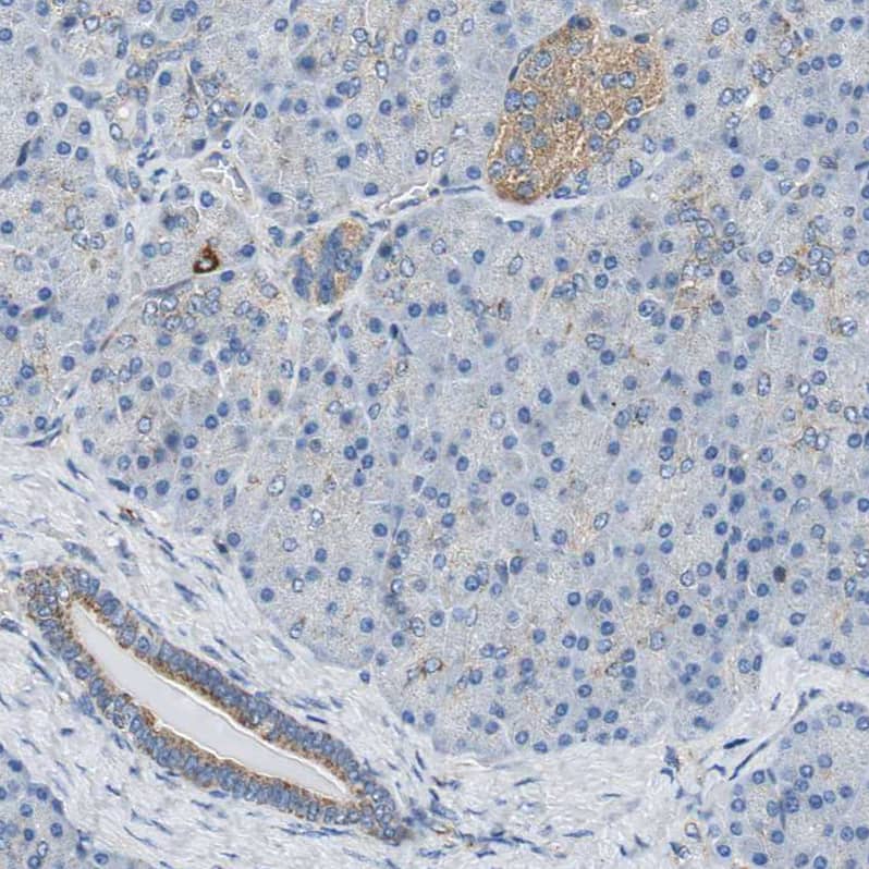 Glutathione S Transferase kappa 1 Antibody - BSA Free Immunohistochemistry-Paraffin: Glutathione S Transferase kappa 1 Antibody - BSA Free [NBP1-89727]
