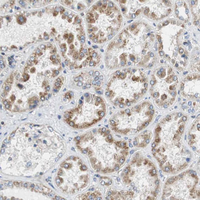 Glutathione S Transferase kappa 1 Antibody - BSA Free Immunohistochemistry-Paraffin: Glutathione S Transferase kappa 1 Antibody - BSA Free [NBP1-89727]