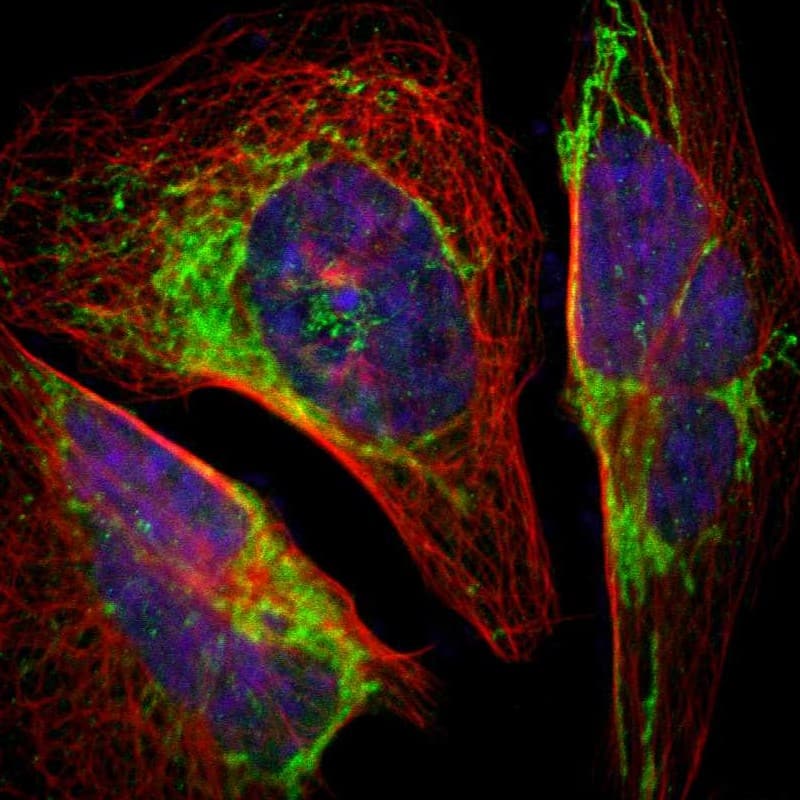 GRP75/HSPA9B/Mortalin Antibody - BSA Free Immunocytochemistry/ Immunofluorescence: GRP75/HSPA9B/Mortalin Antibody [NBP1-89729]