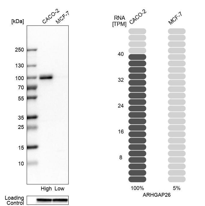 GRAF Antibody - BSA Free Western Blot: GRAF Antibody - BSA Free [NBP1-89732]
