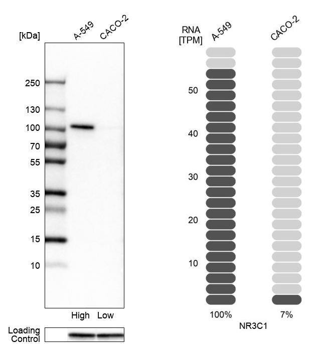 GR/NR3C1 Antibody - BSA Free Western Blot: GR/NR3C1 Antibody - BSA Free [NBP1-89733]