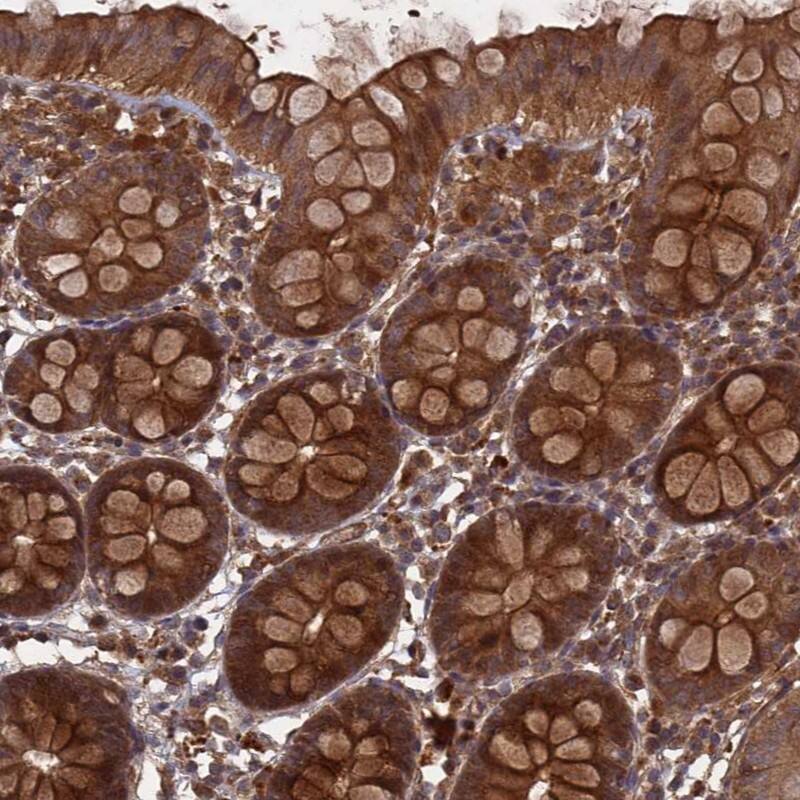 FFAR4/GPR120 Antibody - BSA Free Immunohistochemistry-Paraffin: FFAR4/GPR120 Antibody - BSA Free [NBP1-89739]