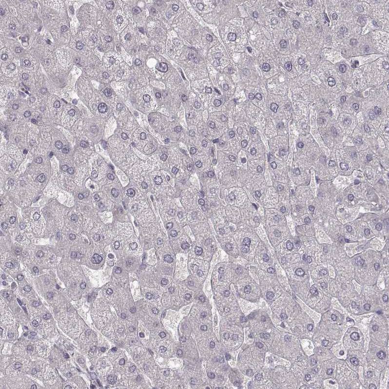 GPR10 Antibody - BSA Free Immunohistochemistry-Paraffin: GPR10 Antibody - BSA Free [NBP1-89741]