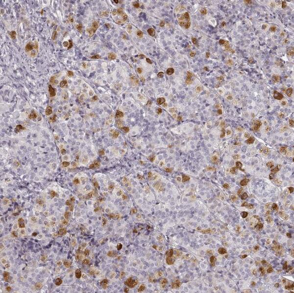 GPR10 Antibody - BSA Free Immunohistochemistry-Paraffin: GPR10 Antibody - BSA Free [NBP1-89741]