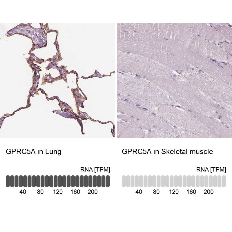 GPRC5A/RAI3 Antibody - BSA Free Immunohistochemistry-Paraffin: GPRC5A/RAI3 Antibody - BSA Free [NBP1-89743]