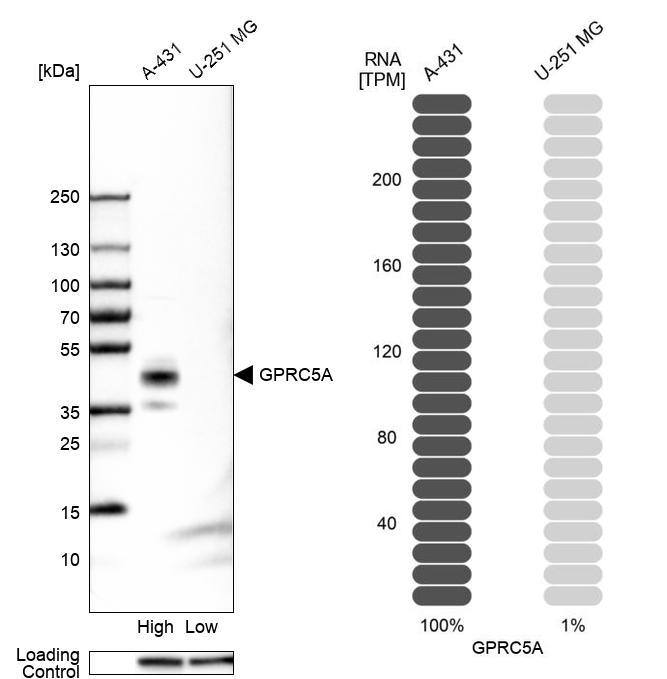 GPRC5A/RAI3 Antibody - BSA Free Western Blot: GPRC5A/RAI3 Antibody - BSA Free [NBP1-89743]