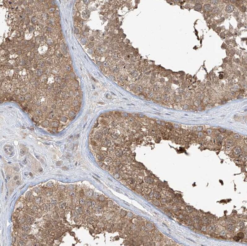 Phosphoribosyl Pyrophosphate Amidotransferase Antibody - BSA Free Immunohistochemistry-Paraffin: Phosphoribosyl Pyrophosphate Amidotransferase Antibody [NBP1-89744]