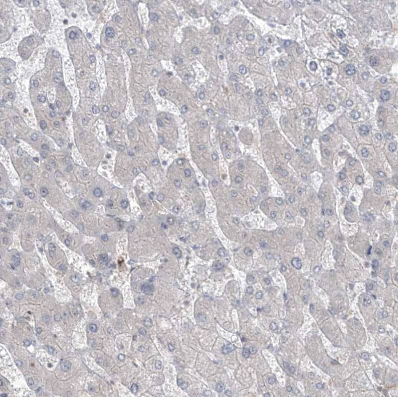 Phosphoribosyl Pyrophosphate Amidotransferase Antibody - BSA Free Immunohistochemistry-Paraffin: Phosphoribosyl Pyrophosphate Amidotransferase Antibody [NBP1-89744]