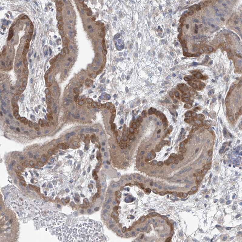 Phosphoribosyl Pyrophosphate Amidotransferase Antibody - BSA Free Immunohistochemistry-Paraffin: Phosphoribosyl Pyrophosphate Amidotransferase Antibody [NBP1-89744]