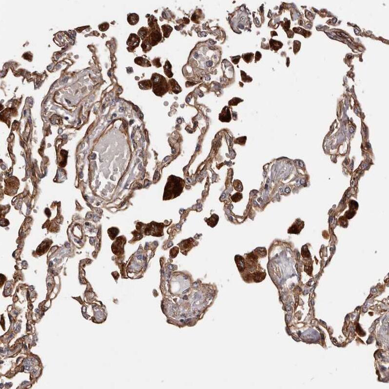 GTP-binding protein 1 Antibody - BSA Free Immunohistochemistry-Paraffin: GTP-binding protein 1 Antibody - BSA Free [NBP1-89746]