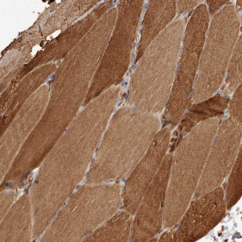 GTP-binding protein 1 Antibody - BSA Free Immunohistochemistry-Paraffin: GTP-binding protein 1 Antibody - BSA Free [NBP1-89746]