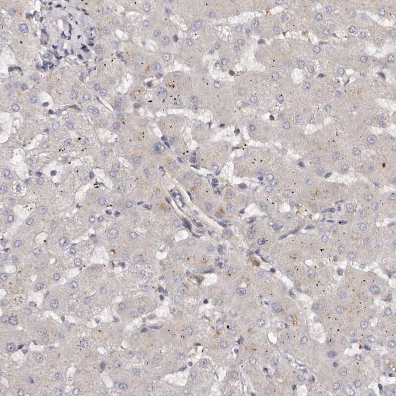 GTP-binding protein 1 Antibody - BSA Free Immunohistochemistry-Paraffin: GTP-binding protein 1 Antibody - BSA Free [NBP1-89746]
