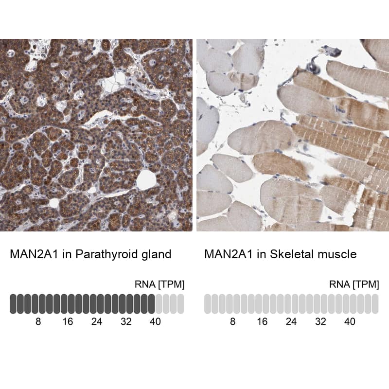 Alpha-mannosidase II Antibody - BSA Free Immunohistochemistry-Paraffin: Alpha-mannosidase II Antibody - BSA Free [NBP1-89748]