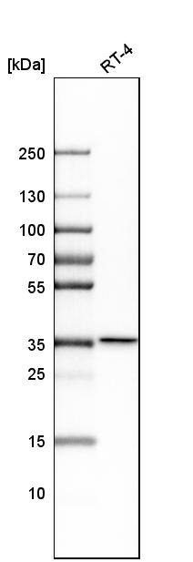 N-Acetyl-D-Glucosamine Kinase/NAGK Antibody - BSA Free Western Blot: N-Acetyl-D-Glucosamine Kinase/NAGK Antibody - BSA Free [NBP1-89750]