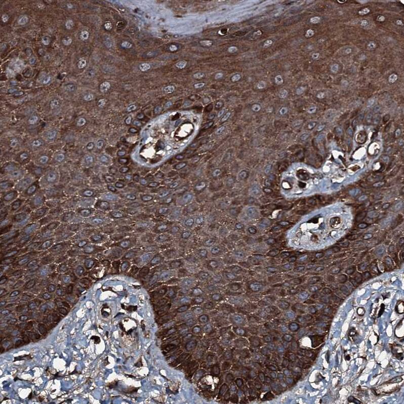 GNIP Antibody - BSA Free Immunohistochemistry-Paraffin: GNIP Antibody [NBP1-89751]