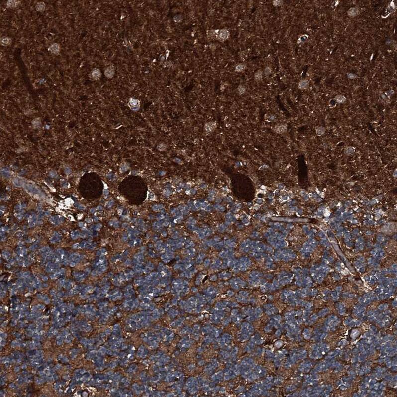 GNIP Antibody - BSA Free Immunohistochemistry-Paraffin: GNIP Antibody [NBP1-89751]