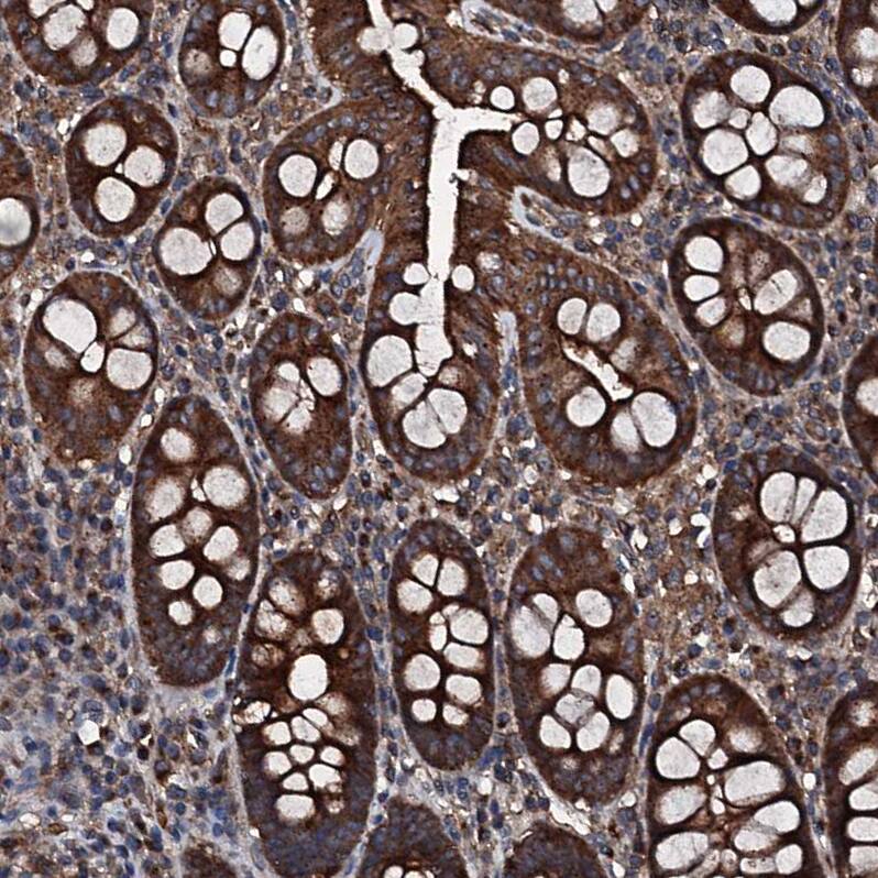 GNIP Antibody - BSA Free Immunohistochemistry-Paraffin: GNIP Antibody [NBP1-89751]