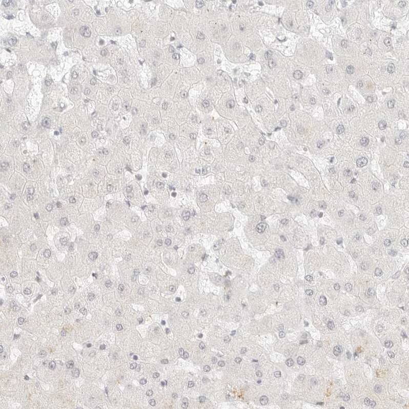G protein alpha Antibody - BSA Free Immunohistochemistry-Paraffin: G protein alpha Antibody - BSA Free [NBP1-89753]