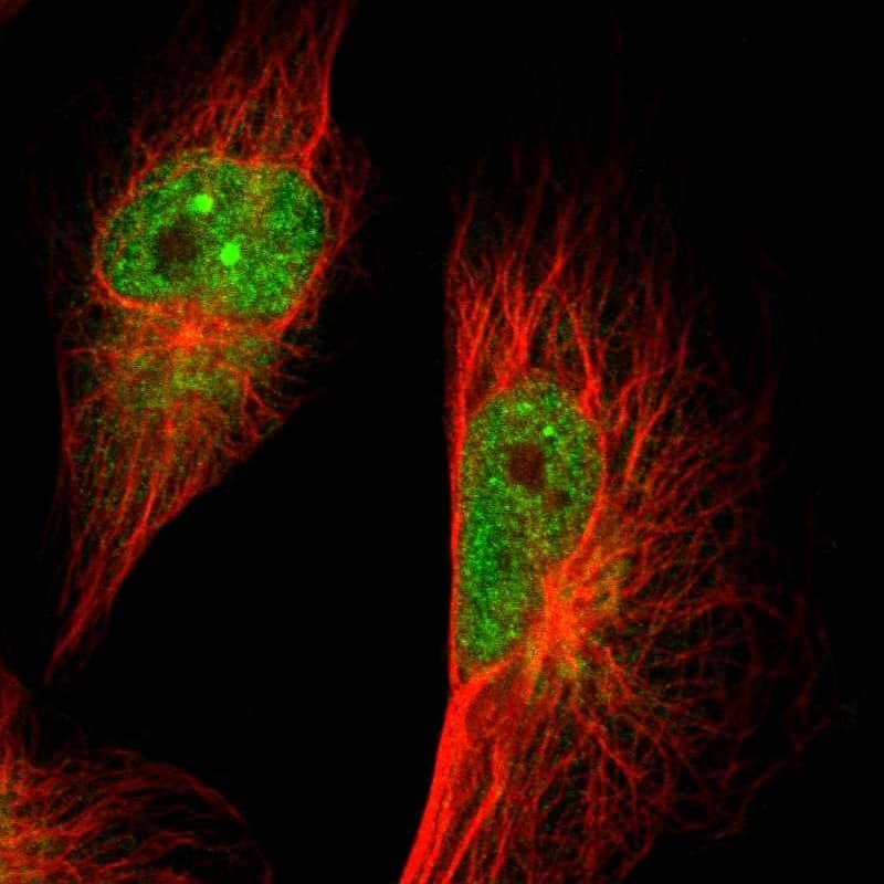 GMF-beta Antibody - BSA Free Immunocytochemistry/ Immunofluorescence: GMF-beta Antibody [NBP1-89755]