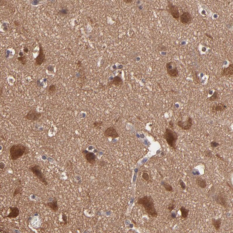 GMF-beta Antibody - BSA Free Immunohistochemistry-Paraffin: GMF-beta Antibody - BSA Free [NBP1-89755]