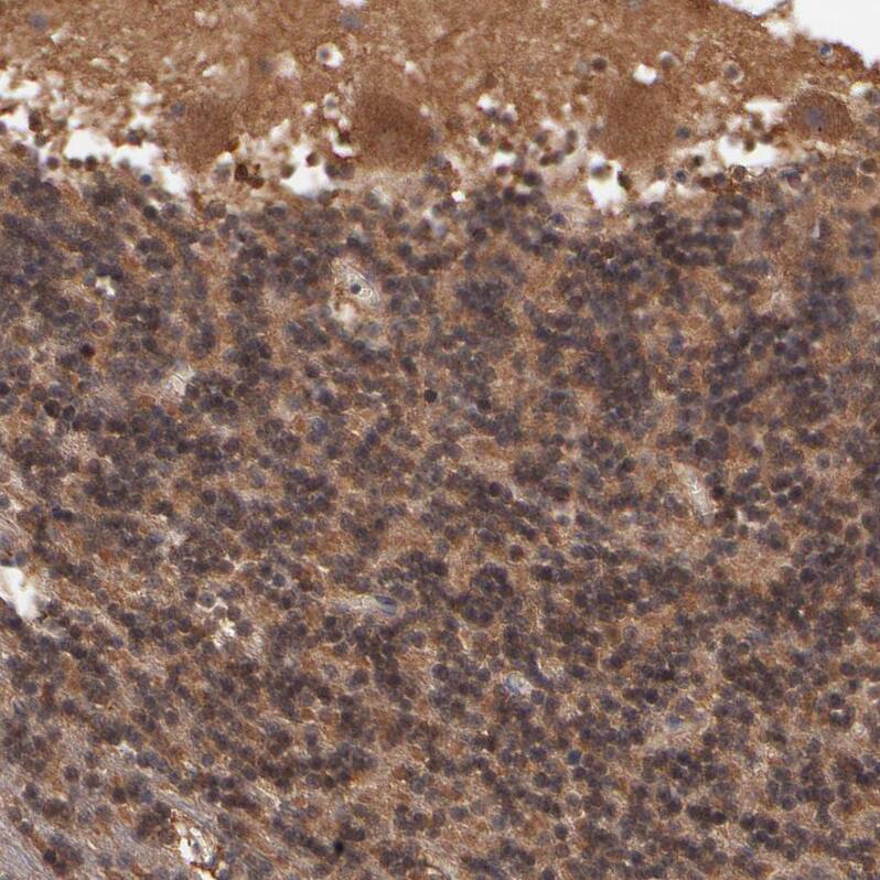 GMF-beta Antibody - BSA Free Immunohistochemistry-Paraffin: GMF-beta Antibody - BSA Free [NBP1-89755]