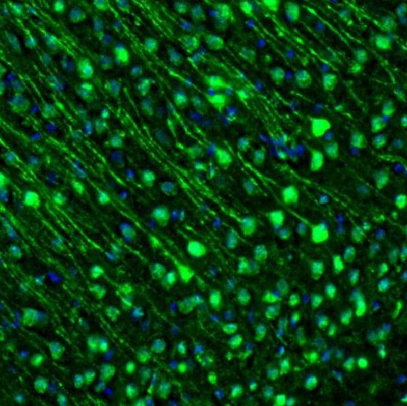 GMF-beta Antibody - BSA Free Immunohistochemistry-Paraffin: GMF-beta Antibody - BSA Free [NBP1-89755]