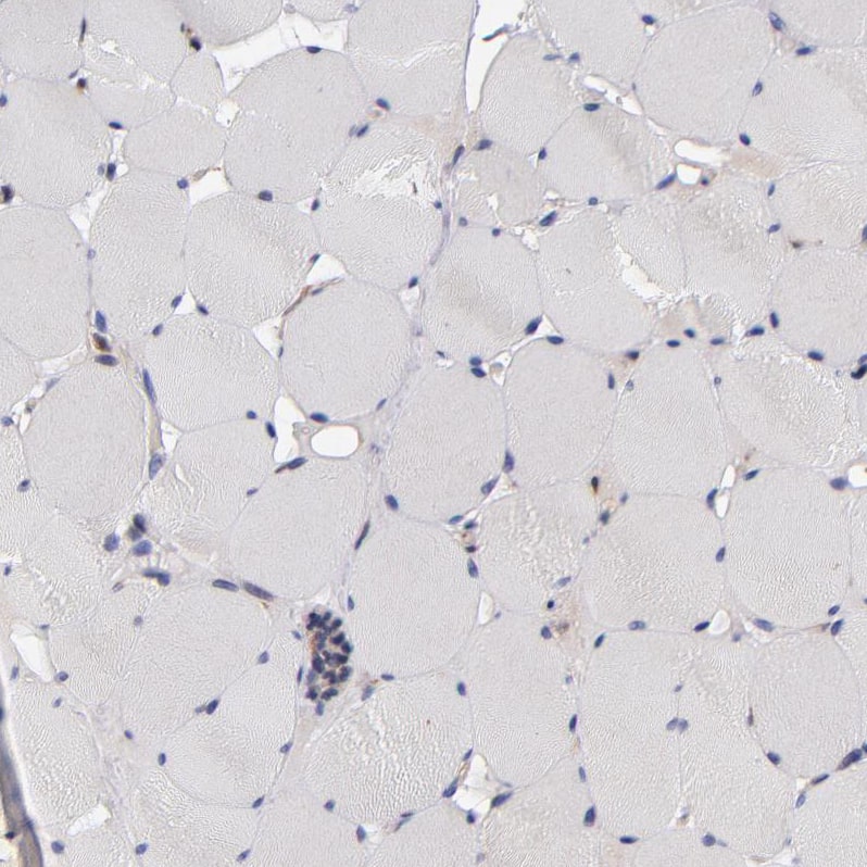 GMF-beta Antibody - BSA Free Immunohistochemistry-Paraffin: GMF-beta Antibody - BSA Free [NBP1-89755]