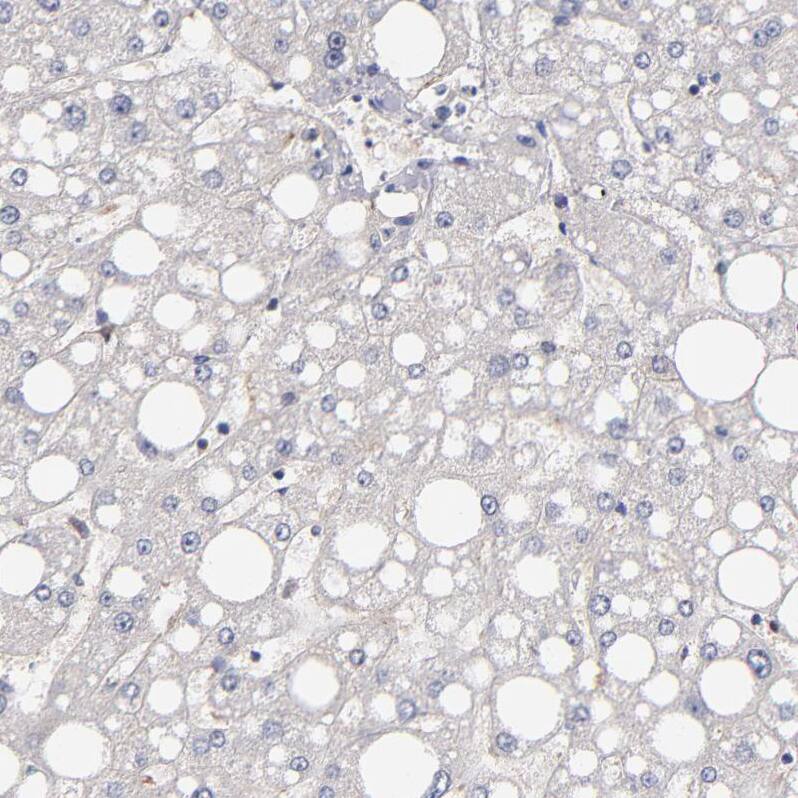 GMF-beta Antibody - BSA Free Immunohistochemistry-Paraffin: GMF-beta Antibody - BSA Free [NBP1-89755]