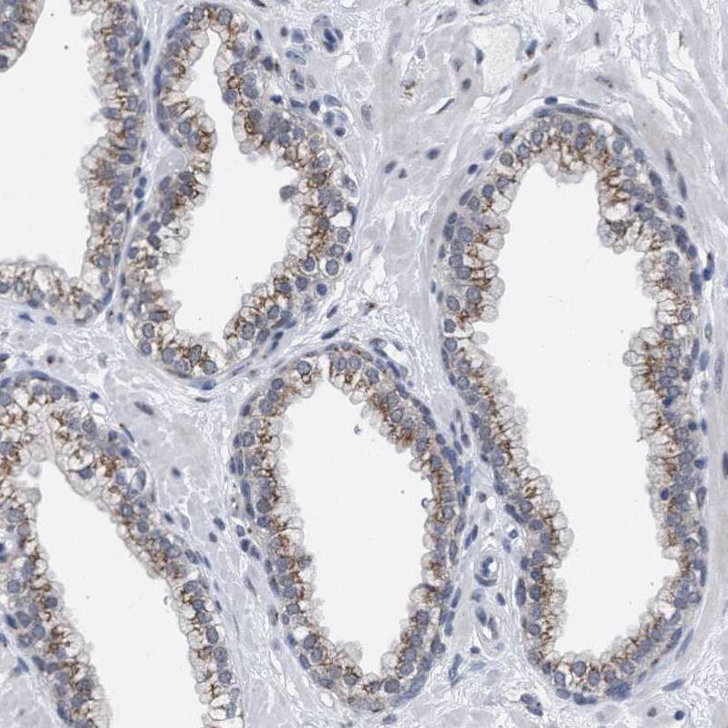 GM130/GOLGA2 Antibody - BSA Free Immunohistochemistry-Paraffin: GM130/GOLGA2 Antibody - BSA Free [NBP1-89756]