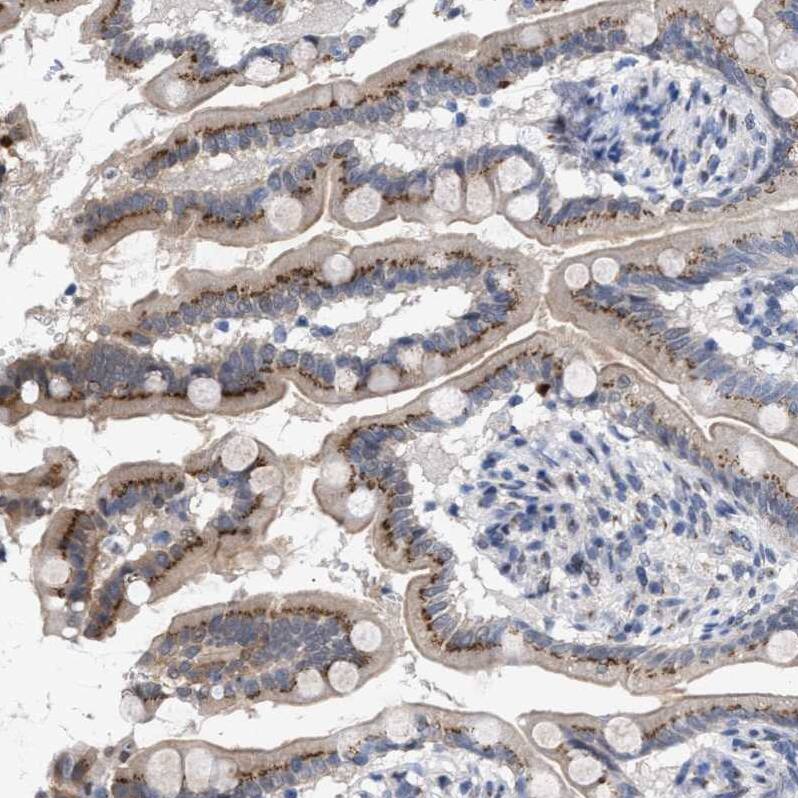GM130/GOLGA2 Antibody - BSA Free Immunohistochemistry-Paraffin: GM130/GOLGA2 Antibody - BSA Free [NBP1-89756]