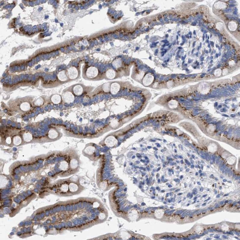 GM130/GOLGA2 Antibody - BSA Free Immunohistochemistry-Paraffin: GM130/GOLGA2 Antibody - BSA Free [NBP1-89757]