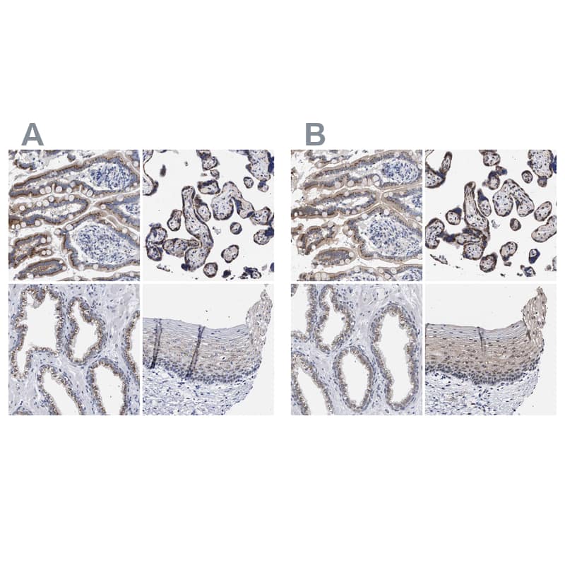 GM130/GOLGA2 Antibody - BSA Free Immunohistochemistry-Paraffin: GM130/GOLGA2 Antibody - BSA Free [NBP1-89757]