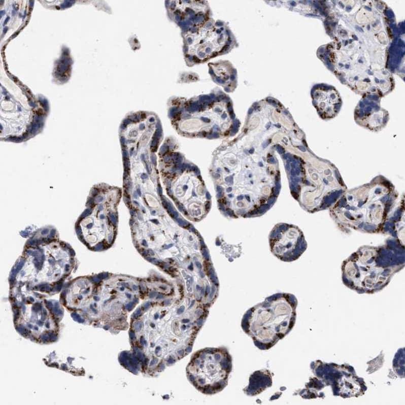 GM130/GOLGA2 Antibody - BSA Free Immunohistochemistry-Paraffin: GM130/GOLGA2 Antibody - BSA Free [NBP1-89757]