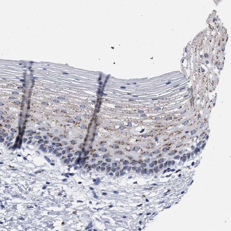GM130/GOLGA2 Antibody - BSA Free Immunohistochemistry-Paraffin: GM130/GOLGA2 Antibody - BSA Free [NBP1-89757]