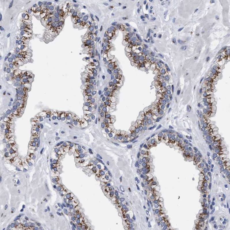 GM130/GOLGA2 Antibody - BSA Free Immunohistochemistry-Paraffin: GM130/GOLGA2 Antibody - BSA Free [NBP1-89757]