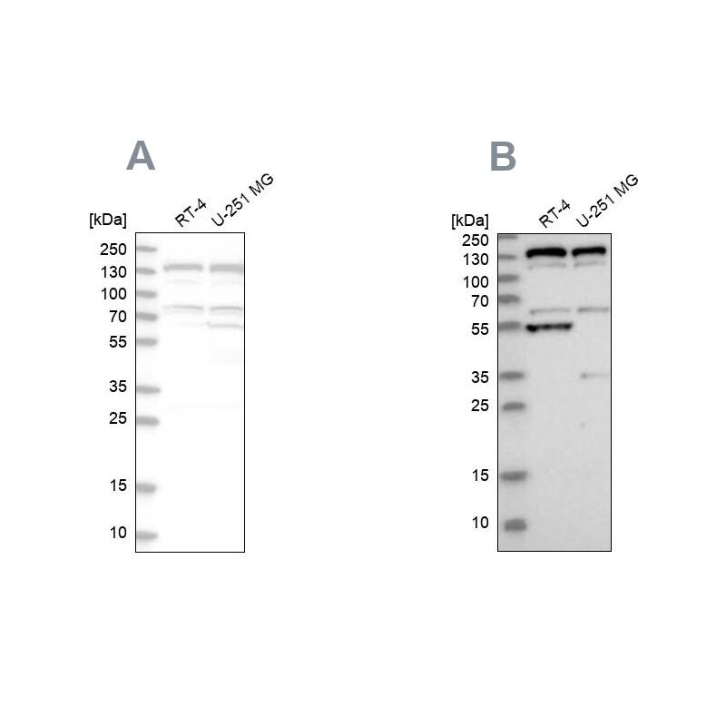 GM130/GOLGA2 Antibody - BSA Free Western Blot: GM130/GOLGA2 Antibody - BSA Free [NBP1-89758]