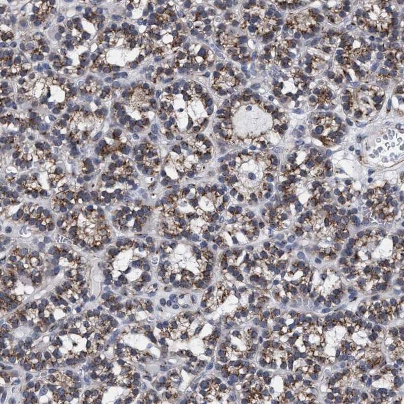 GM130/GOLGA2 Antibody - BSA Free Immunohistochemistry-Paraffin: GM130/GOLGA2 Antibody - BSA Free [NBP1-89758]