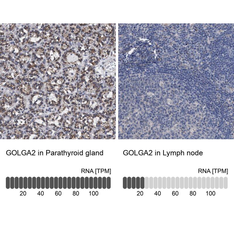 GM130/GOLGA2 Antibody - BSA Free Immunohistochemistry-Paraffin: GM130/GOLGA2 Antibody - BSA Free [NBP1-89758]