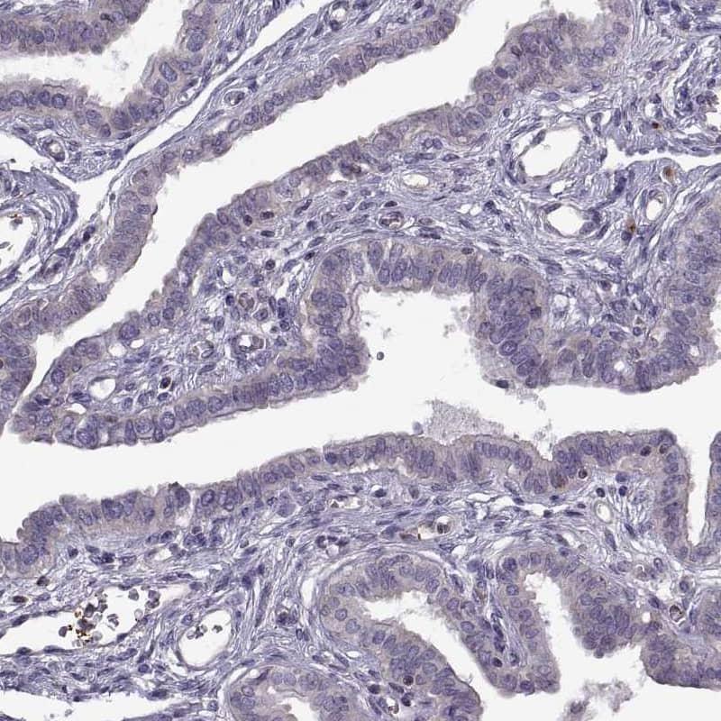 Glut3 Antibody - BSA Free Immunohistochemistry-Paraffin: Glut3 Antibody - BSA Free [NBP1-89762]