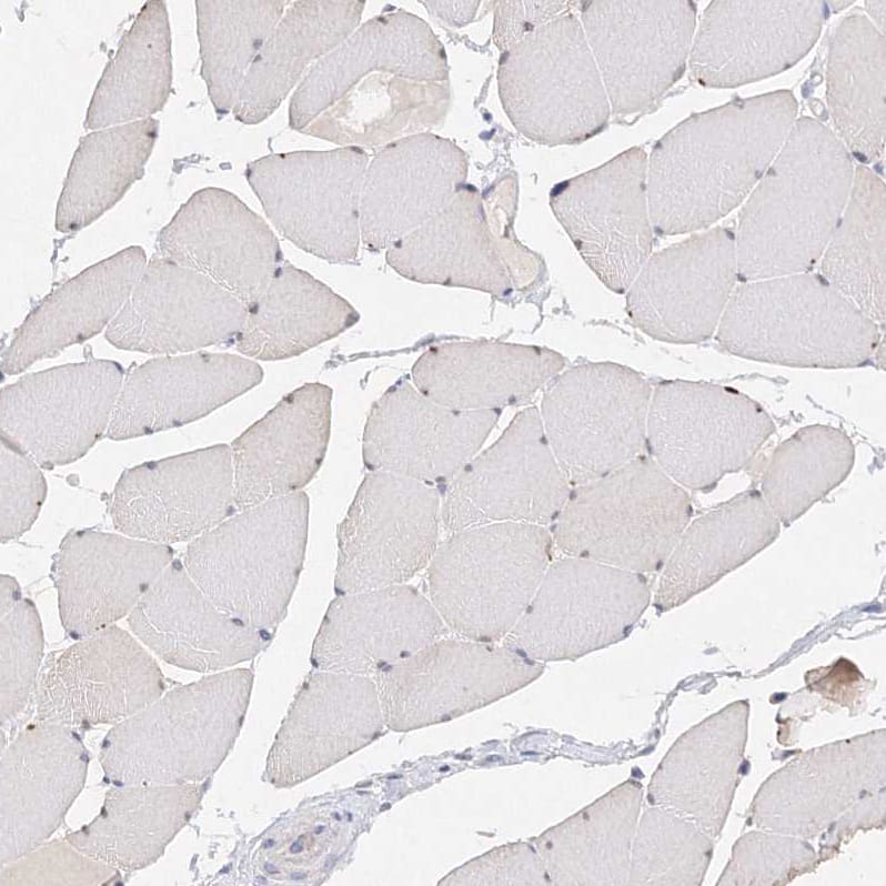 Glutaminase Antibody - BSA Free Immunohistochemistry-Paraffin: Glutaminase Antibody [NBP1-89766]