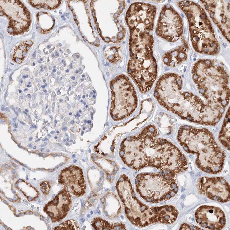 Glutaminase Antibody - BSA Free Immunohistochemistry-Paraffin: Glutaminase Antibody [NBP1-89766]