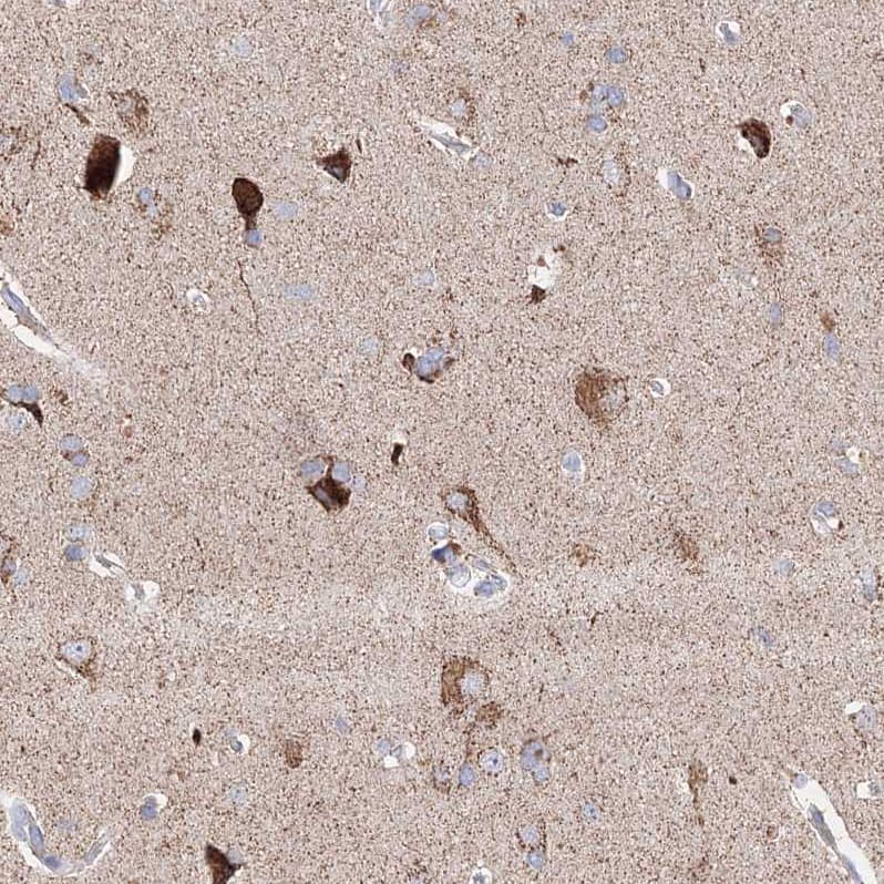 Glutaminase Antibody - BSA Free Immunohistochemistry-Paraffin: Glutaminase Antibody [NBP1-89766]